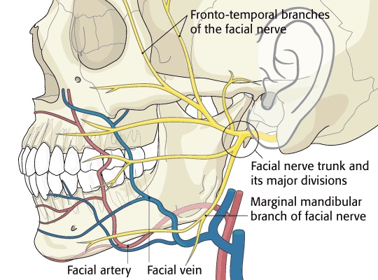 nervo mandibular marginal, lipoaspiração de papada
