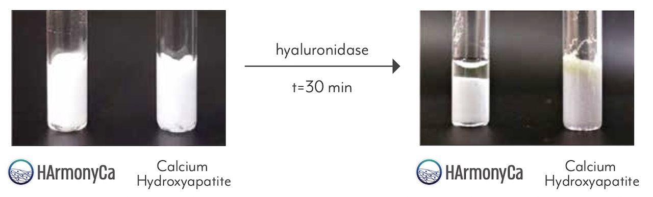 HarmonyCA, bioestimuladores, hidroxiapatita de cálcio