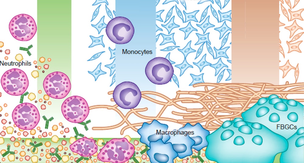 Agregado plaquetário é um material Bioestimulador?